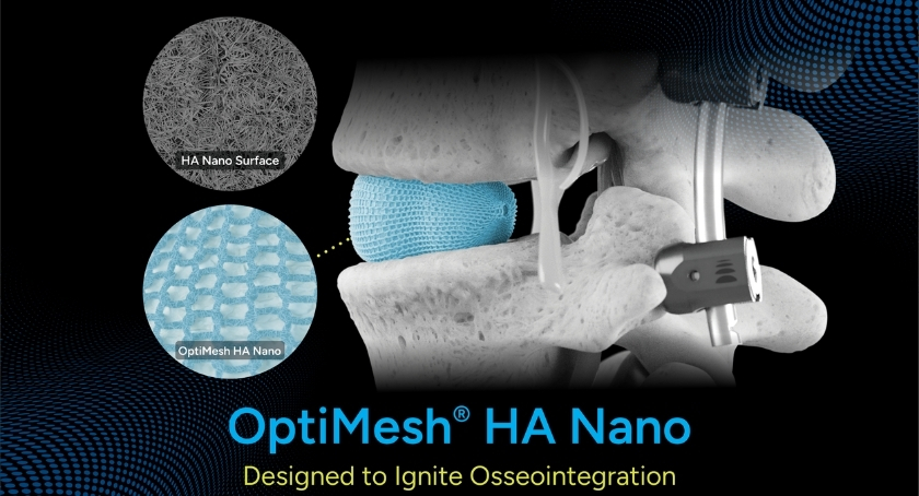 Spineology Launches OptiMesh HA Nano Implant